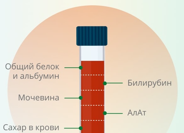 Общий анализ крови при раке желудка: частые ошибки и правильная логика обследования