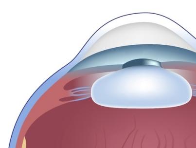 Ciliär (ciliär) kropp: struktur, funktioner Ciliär kropp av ögat
