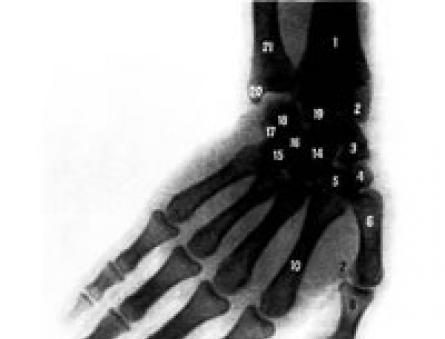 Varför gör handledsleden ont: anatomi, orsaker och behandling av smärta